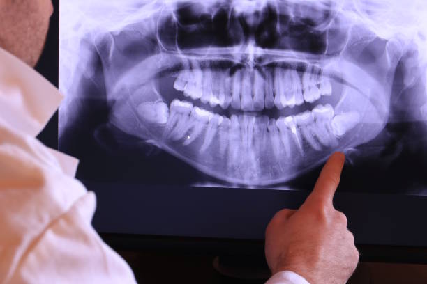 Best Emergency Treatment for Dental Infections or Abscesses in Watervliet, NY