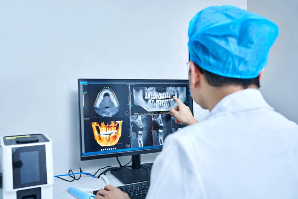 Best Emergency Dental Care for Broken or Chipped Teeth in Watervliet, NY